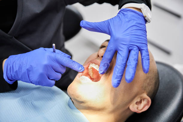Best Mobile Emergency Dentist in Big Bear Lake, CA